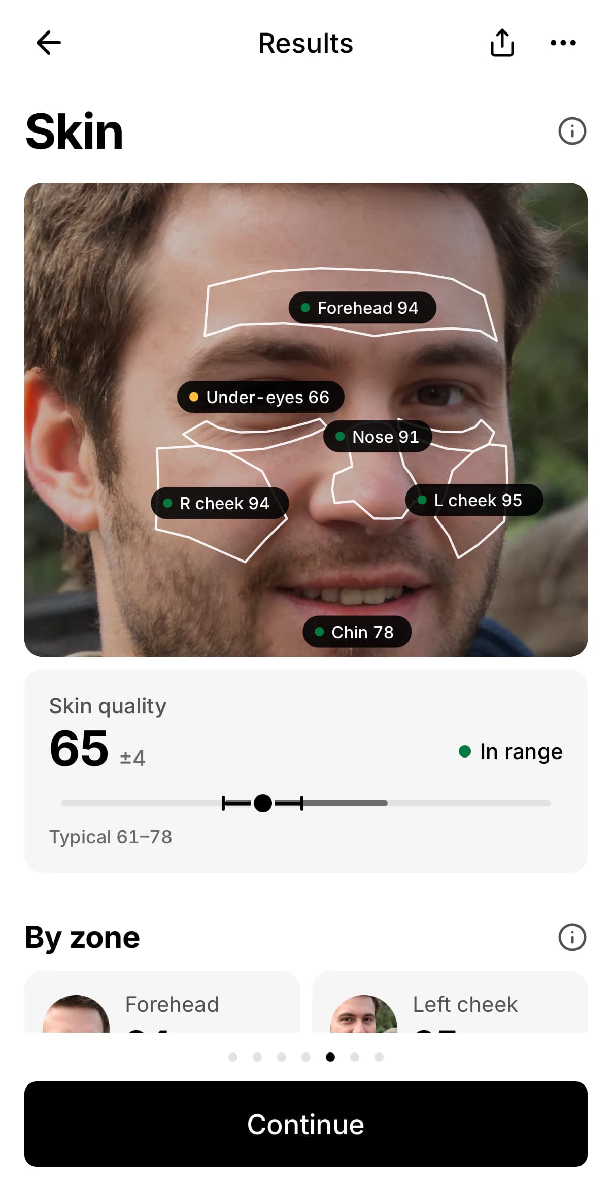 LookFlex skin page: skin zones outlined on a face photo with scores for forehead, under-eyes, nose, cheeks and chin, and a skin quality score of 65 with its margin and typical range. The example face is AI-generated.